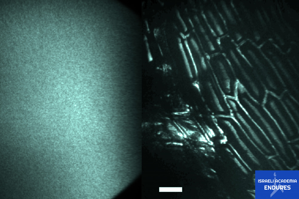 revoutionizing optical imaging huji