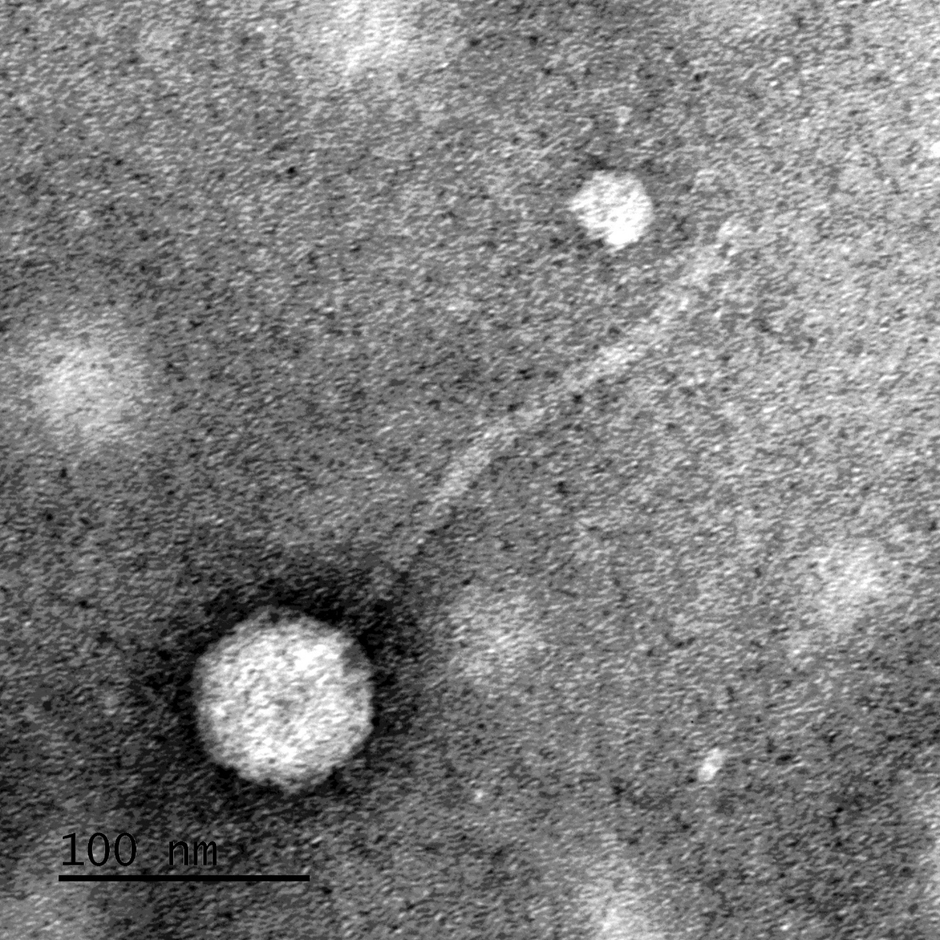 KpRaz1 Phage | Credit: Edi Bernstein, Electron Microscopy Unit, Interdepartmental Equipment, Ein Kerem Campus of the Hebrew University.